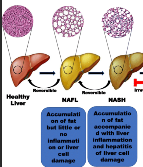 <p>What drugs can cause <strong>Nonalcoholic Steatohepatitis (NASH) or Nonalcoholic fatty liver disease (NAFLD)</strong>?</p>