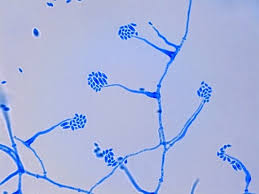<p>Acremonium</p>