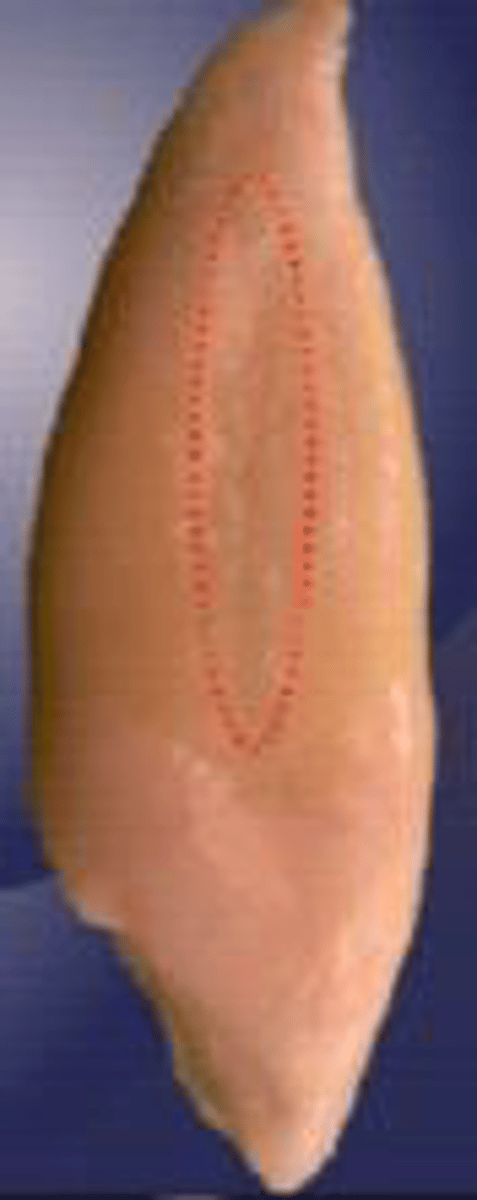 <p>what tooth is this?</p>