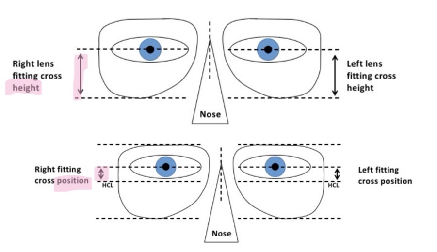 <p>Make sure frame is sitting in the right place before taking measurements </p><p>2 methods of defining vertical positioning:</p><p>Fitting cross height - distance between pupil centre and a tangent to the lowest point of the lens </p><p>Fitting cross position - distance between pupil centre and the horizontal centre line of the frame </p><p>Measurement will need a sign to specify whether the fitting cross should be above or below the HCL</p><p>Above HCL = +</p><p>Below HCL = -</p><p></p>