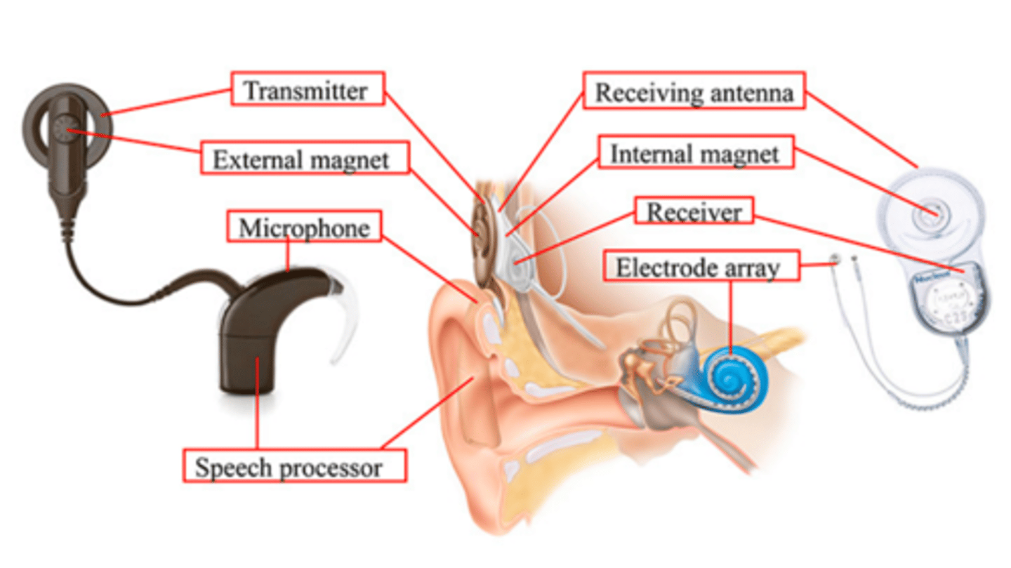 <p>Microphone</p><p>Speech processor</p><p>Transmitter</p><p>receiver/stimulator</p><p>Electrode array</p><p>Cochlea</p><p>Auditory nerve</p>