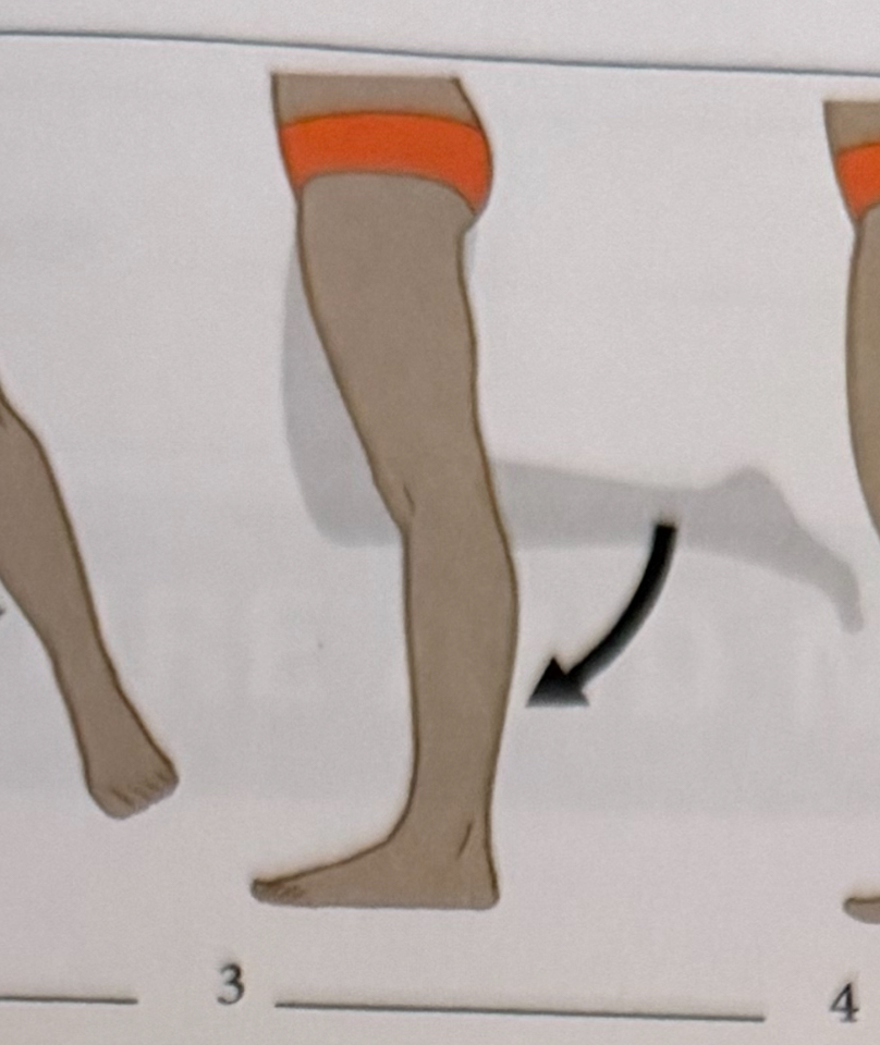 <p>decreasing the angle of a joint</p>