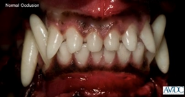 Canine Dental Formulas incisors
upper/lower