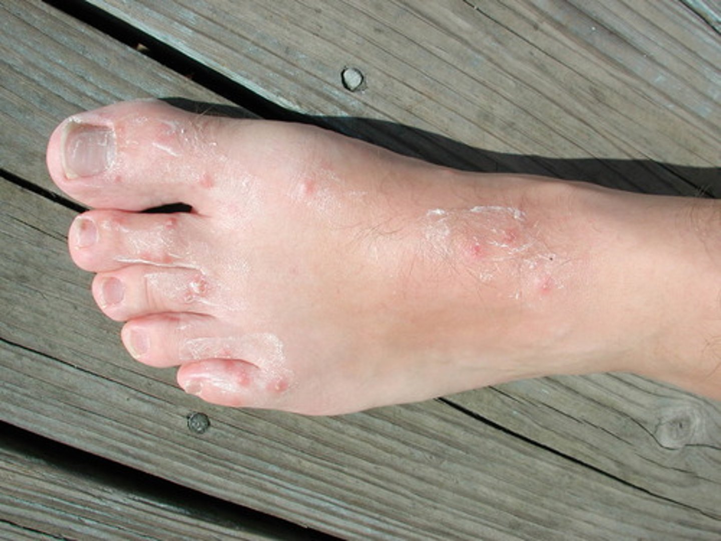 <p>foot</p>