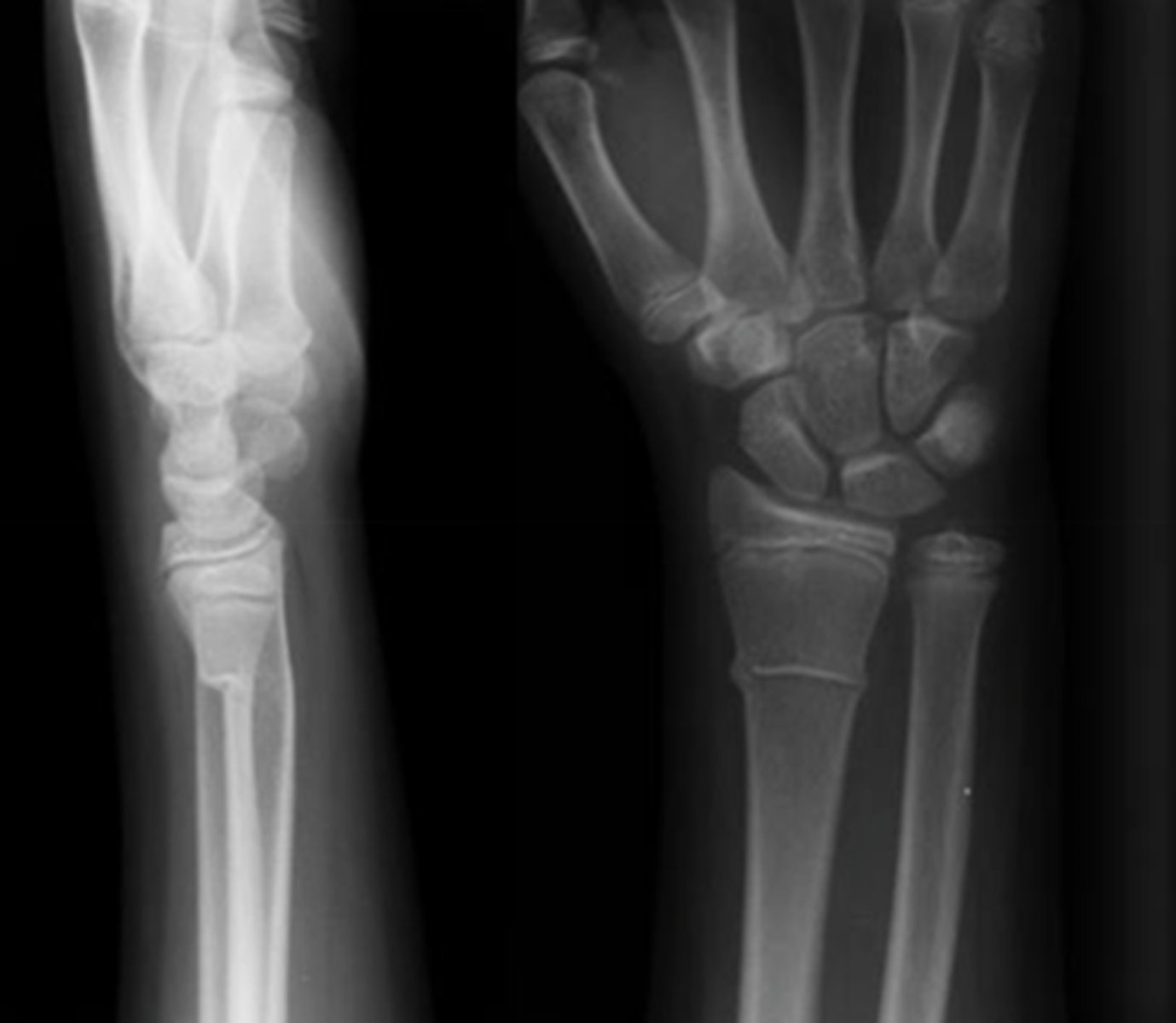 <p>Incomplete fx</p>