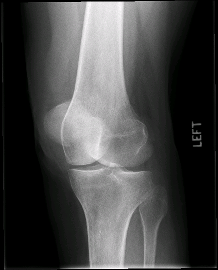 <p>what is the critique of this medial oblique?</p>