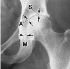 <p>Q what is the name of this measurement? and what is the average + range?</p>