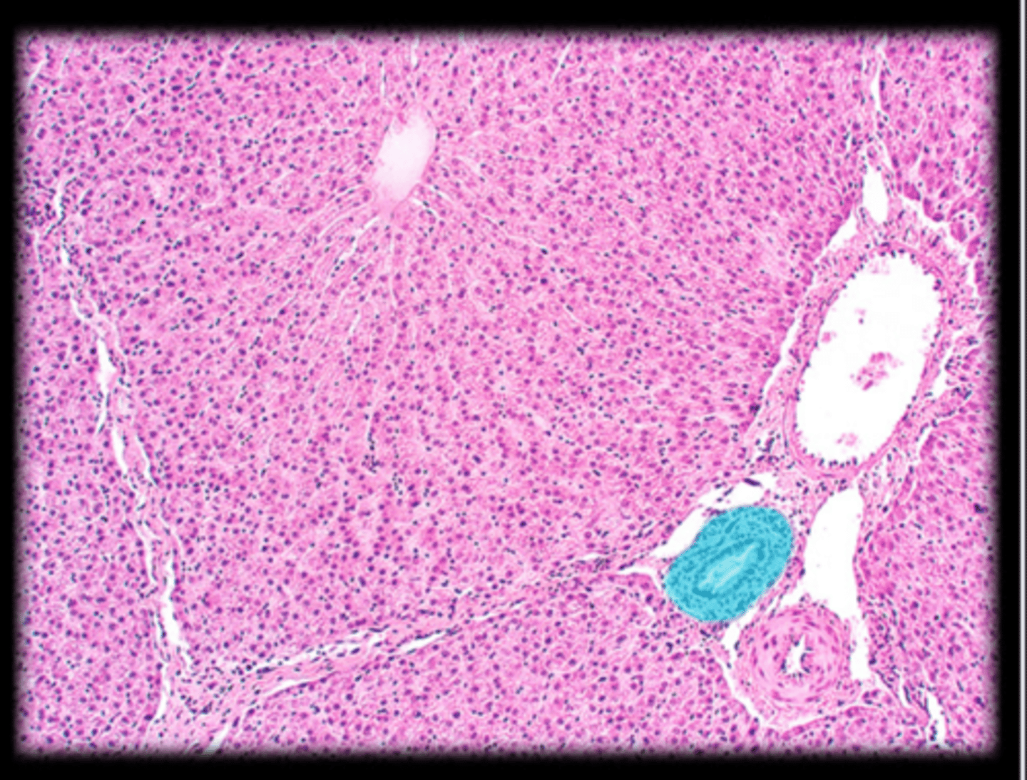 <p>collects bile made by hepatocytes; lined by simple cuboidal epithelium</p>