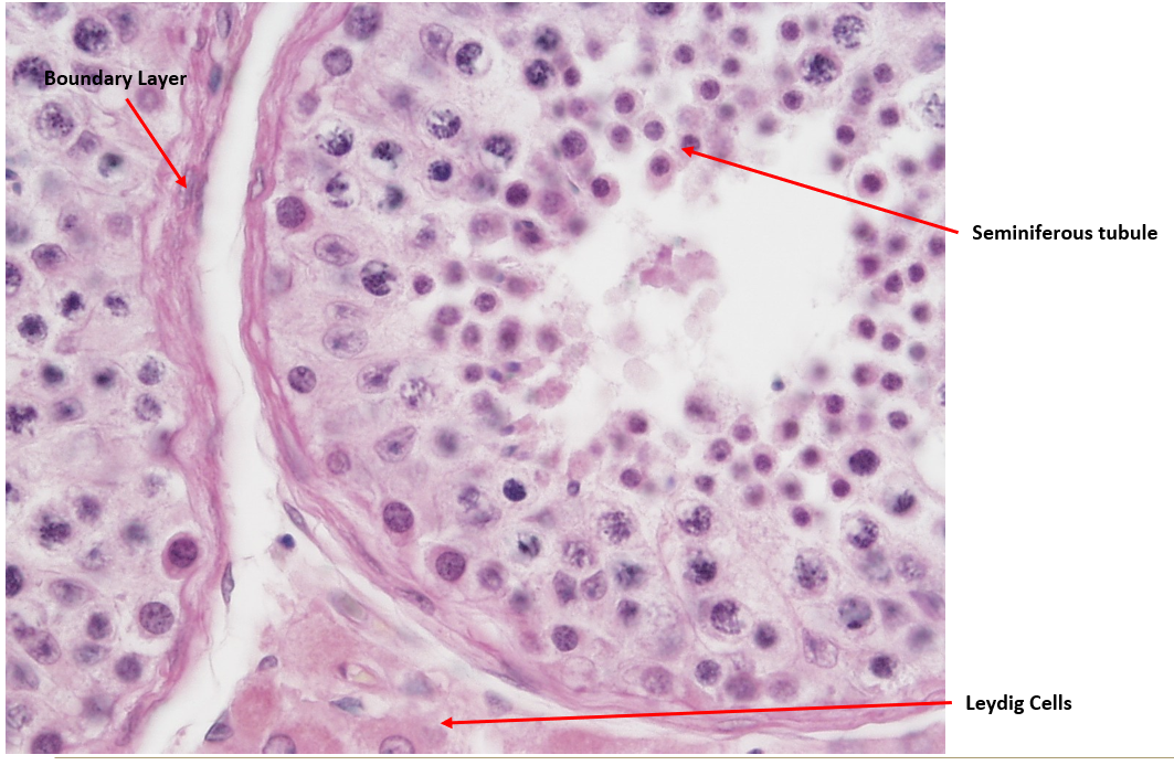 <p>Seminiferous tubule.</p><ul><li><p><strong>Nuclei visible </strong>surrounding lumen (unlike epididymis)</p></li><li><p class=""><strong>Leydig = testosterone factory </strong>(outside seminiferous tubules)</p></li><li><p class=""><strong>Sertoli = sperm babysitters </strong>(inside </p></li></ul><p></p>