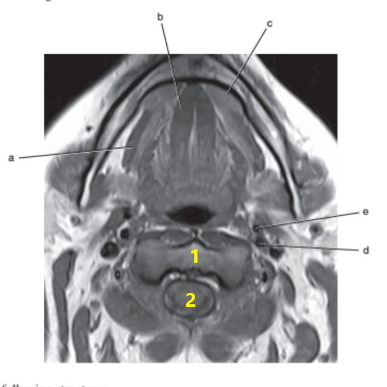 <p>What is letter d ?</p>