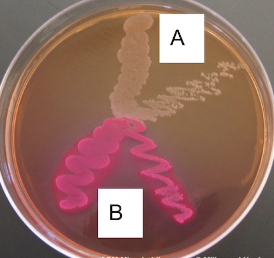 <p><strong>6.</strong><span> In the image below, bacteria are grown on MacConkey Agar. Which species is Gram-negative?</span></p><p>Solution:</p><ol><li><p>A</p></li><li><p>B</p></li><li><p>Both</p></li><li><p>Neither</p></li></ol><p></p>