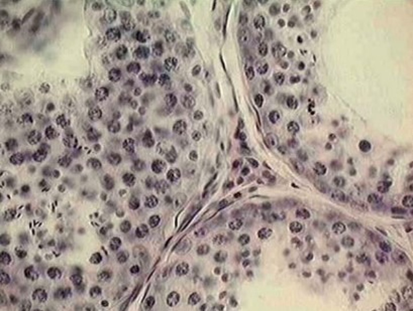<p>Leydig (interstitial) cells in seminiferous tubules</p>