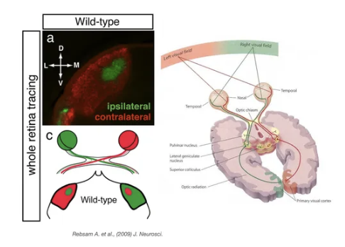 <p>goes from cell body (retina), which sends projections into thalamus → send into visual cortex (occipital lobe)</p>