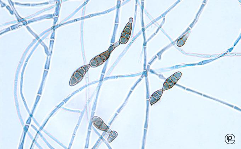 <p>septate hyphae and dark large conidia, club shaped</p>
