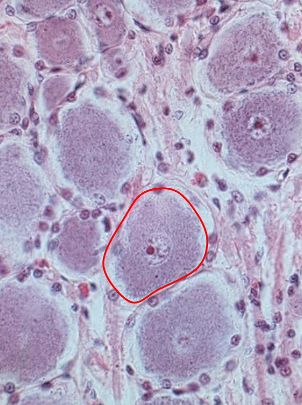 term image