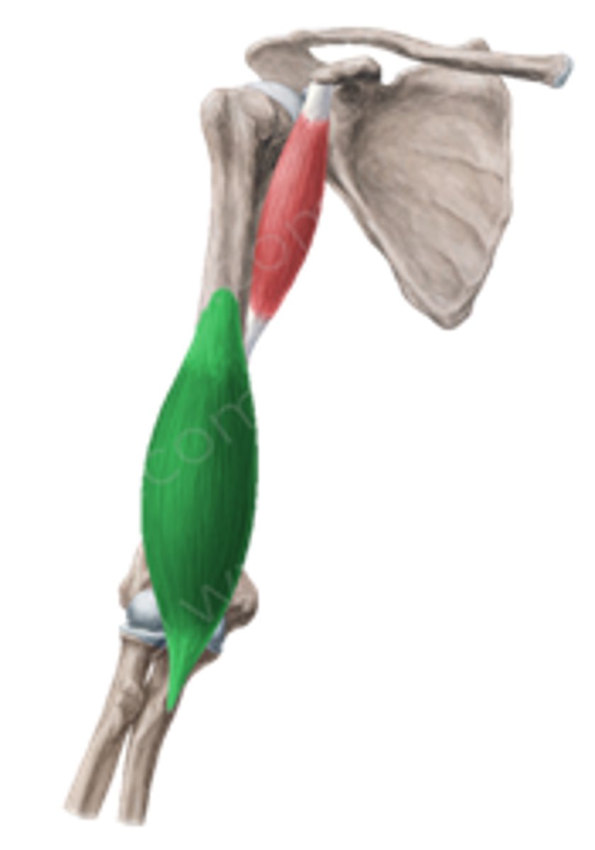 <p>Welke spier is dit?</p>