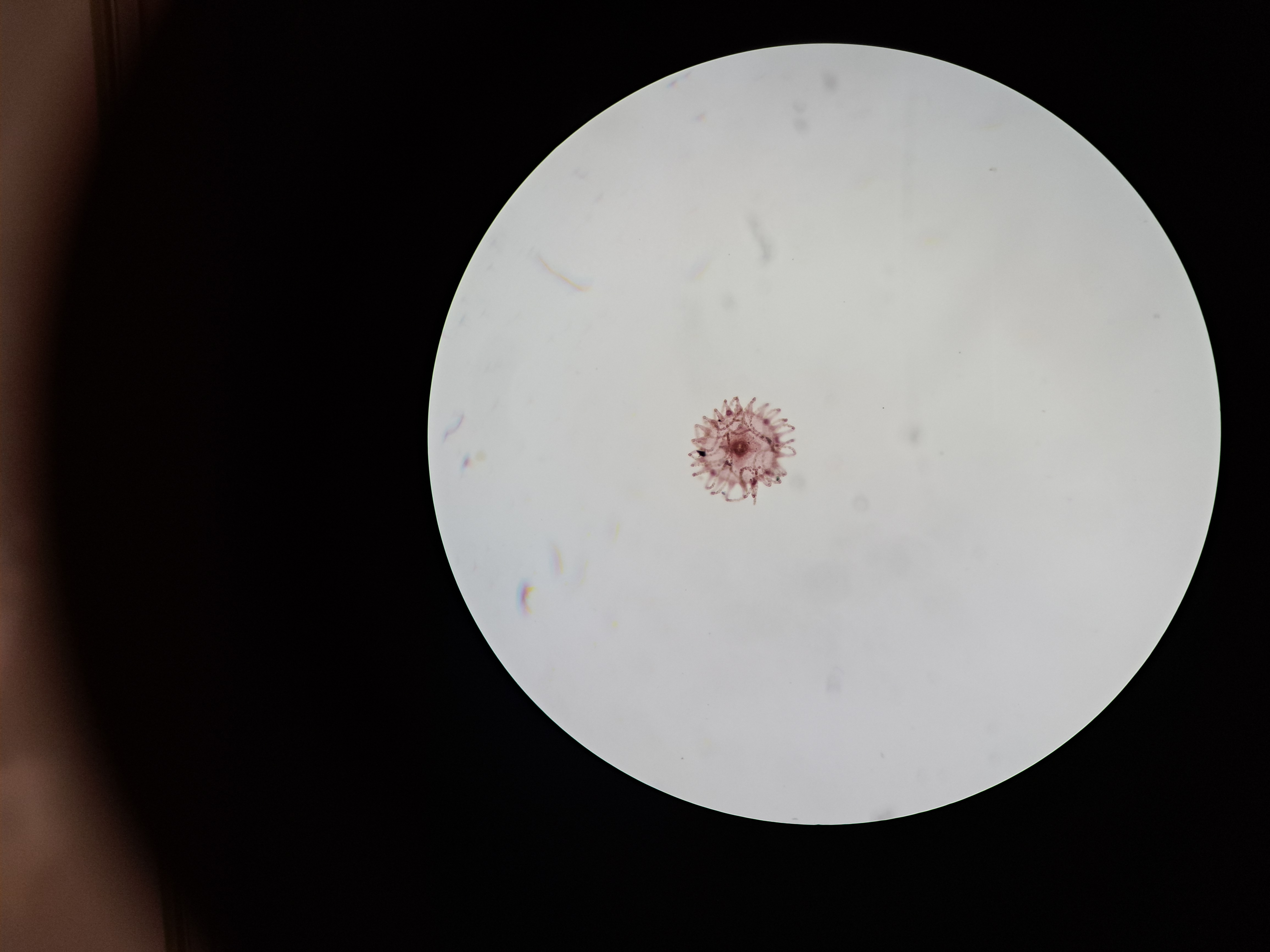 <p>kmen: CNIDARIA (žahavci)</p>