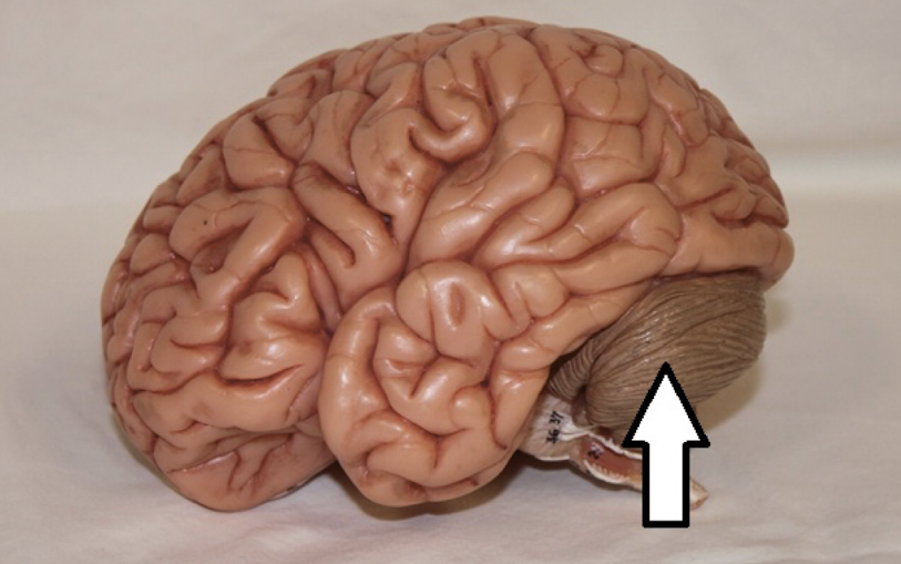 <p>identify the structure (part of brain in arrow).</p>