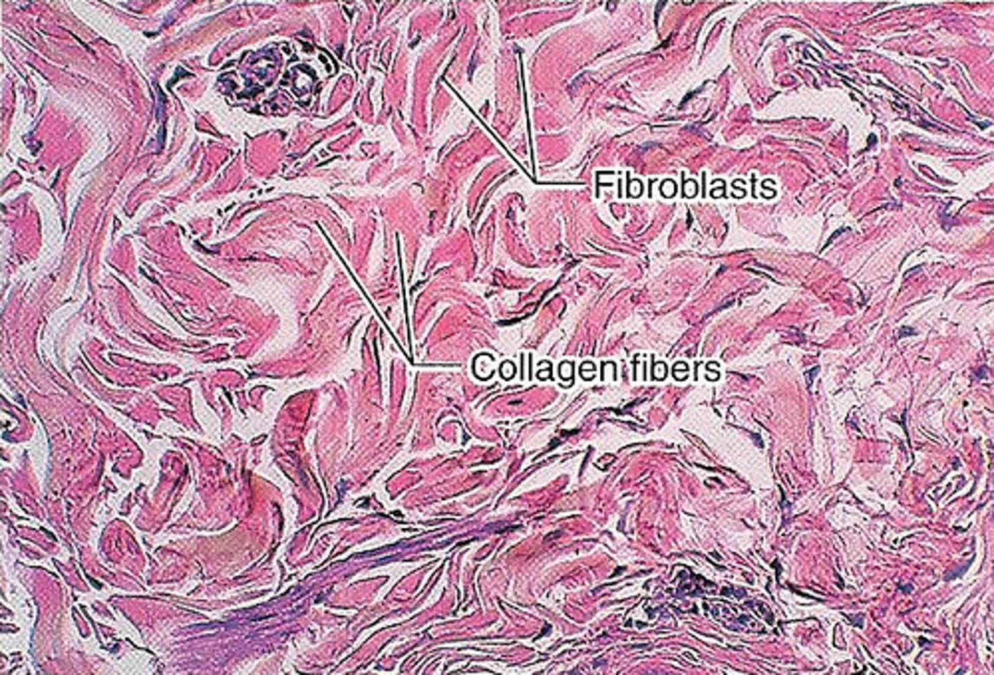 <p>-collagen</p><p>-scanty ground substance</p><p>-few visible cells</p><p>-scanty blood vessels</p>
