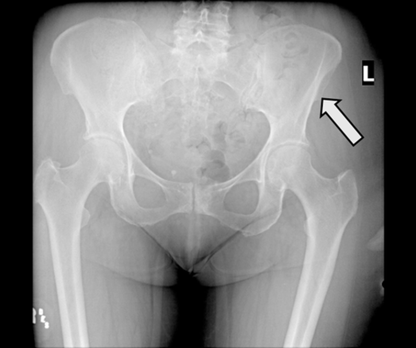 <p>What is indicated in the image?</p>