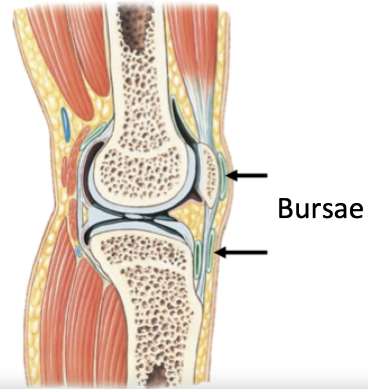 <p><strong>Bursa (bursae pl.)</strong></p><ul><li><p>Small fluid-filled pockets in connective tissue, occur around tendons and bones</p></li><li><p>Filled with synovial fluid, lined by a synovial membrane</p></li><li><p>Reduce friction</p></li><li><p>Act as shock absorbers</p></li></ul>