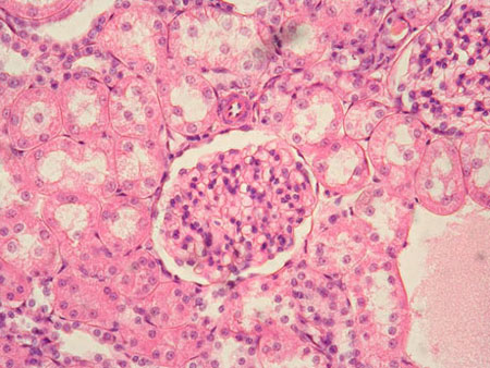 <p>What type of epithelium is indicated by the green arrow?</p>