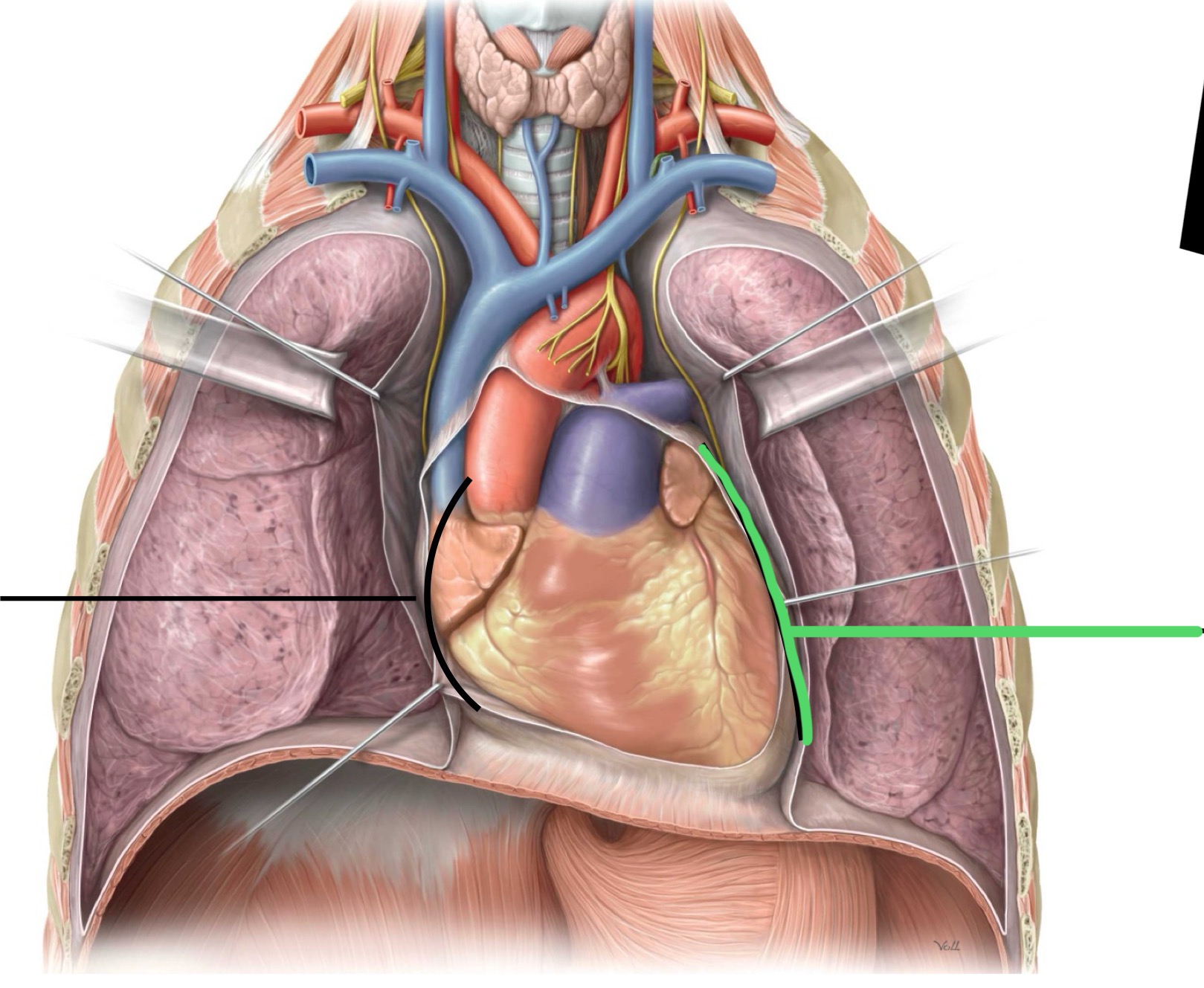 <p>What surface is identified by the green line?</p>