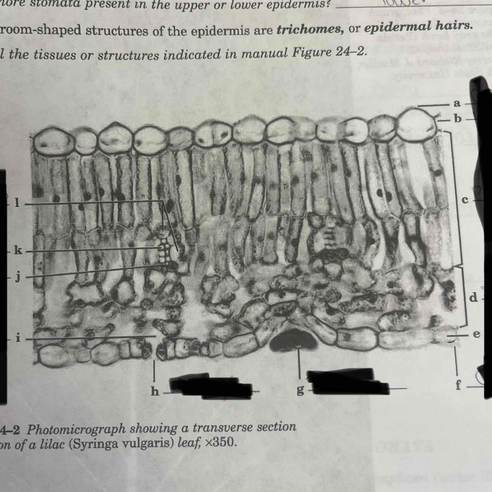 <p>Label the tissues or structures indicated</p>