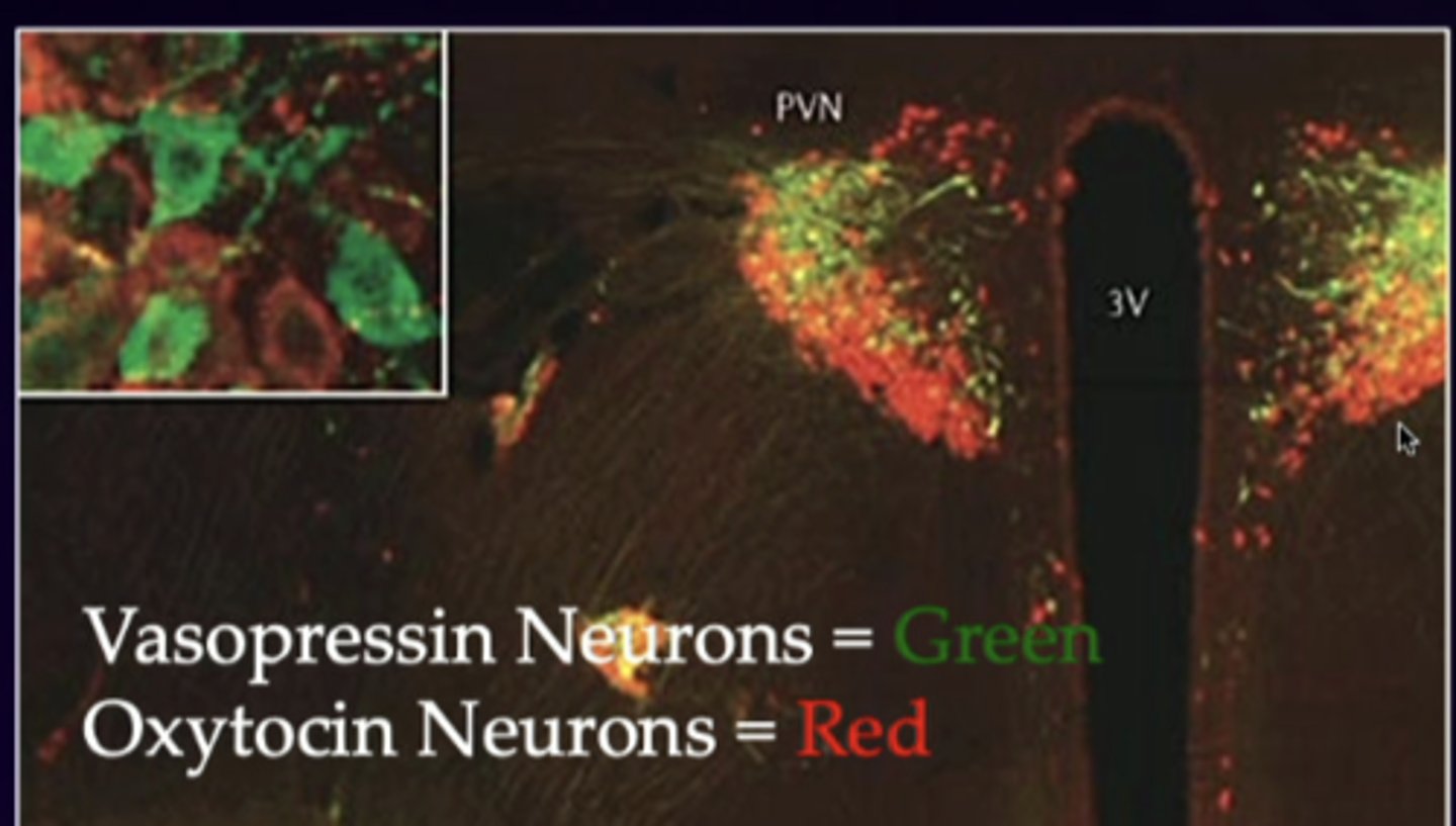 <p>made in the hypothalamus and released in the posterior pituitary</p>