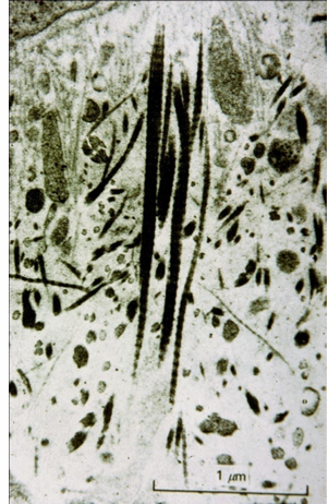 <p>-in mantle dentin (approximately 100um), two populations of collagen fibers exist:</p><p>-typical dentin collagen fibers parallel with DEJ</p><p>-thicker fibers perpendicular to DEJ</p>