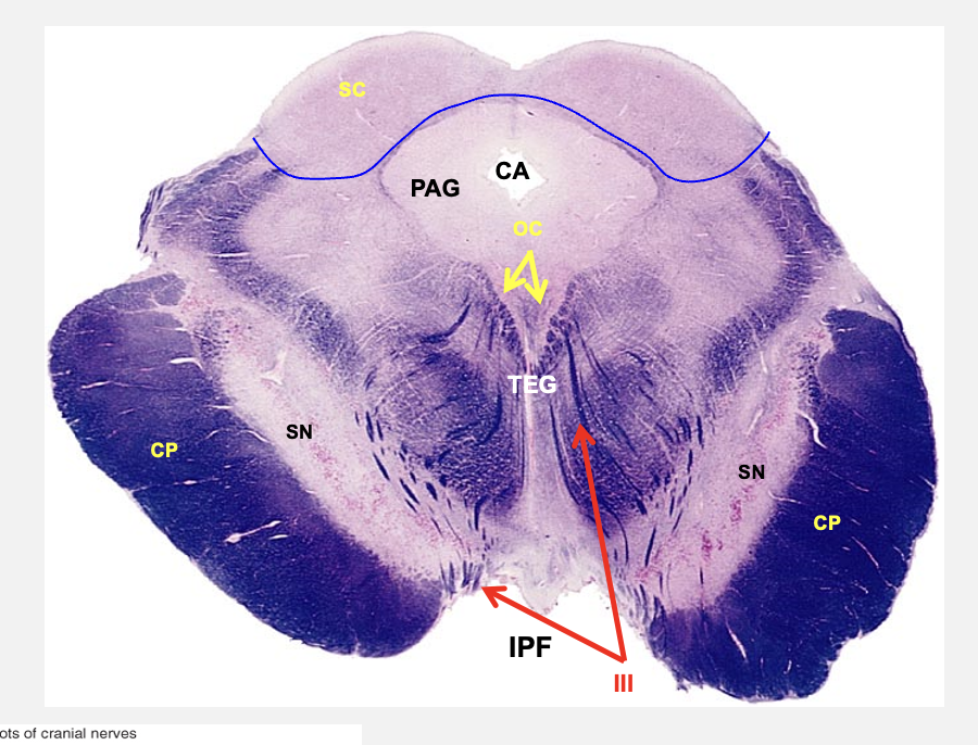 <p>middle midbrain cross-section features </p>