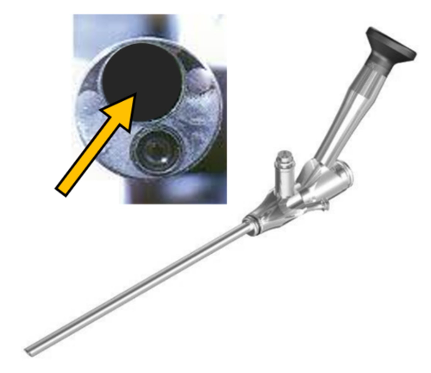 <p>an endoscope with a working channel (lumen) that instruments or accessories can pass through to perform surgical procedures</p>