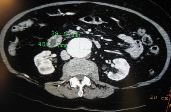 <p>What does this CT refer to</p>