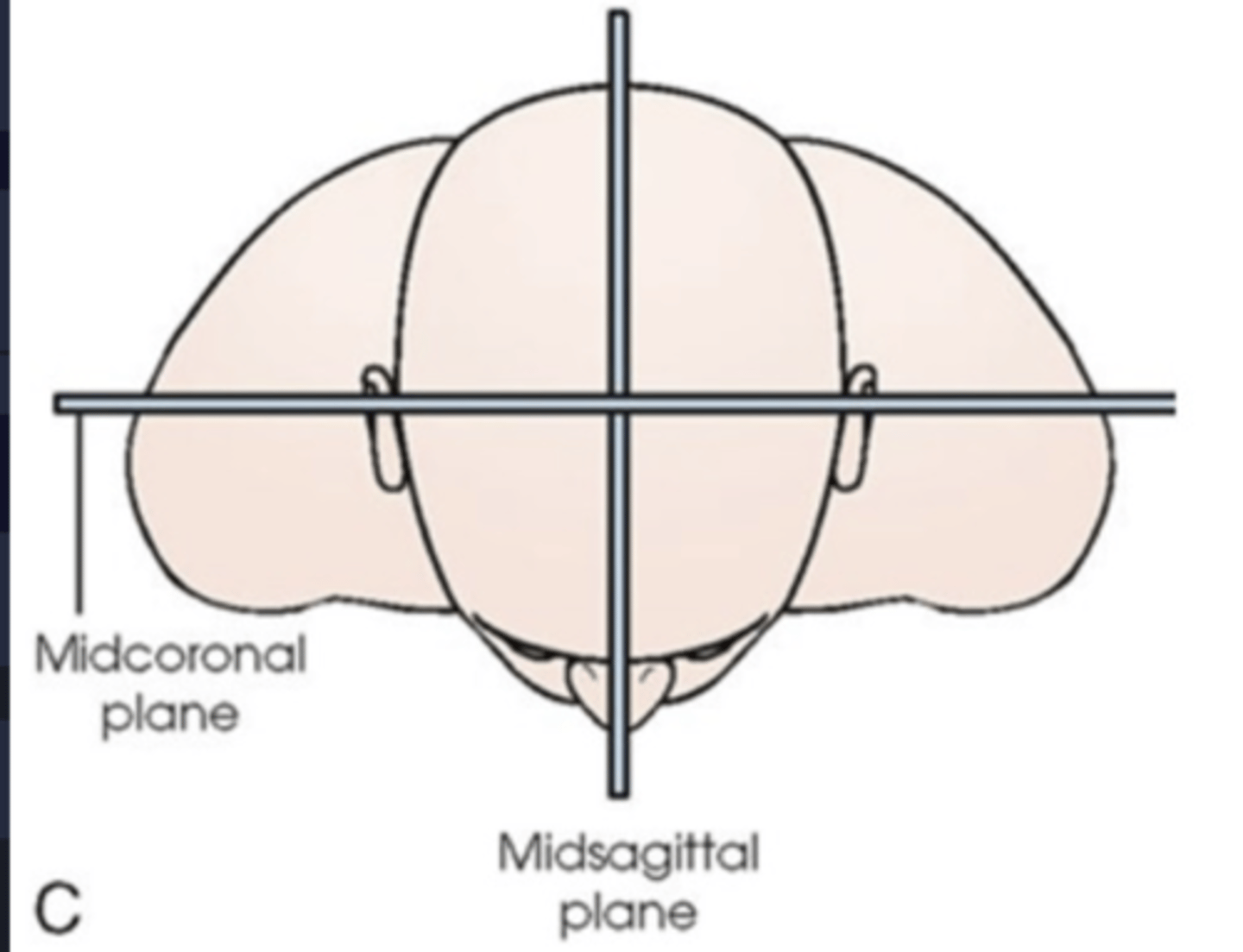 <p>parallel to IR (IR is on the right side)</p>