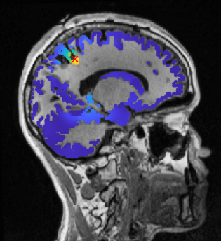 <ul><li><p>brain imaging technique that measures magnetic fields from the brain’s natural electrical activity</p></li></ul><p></p>