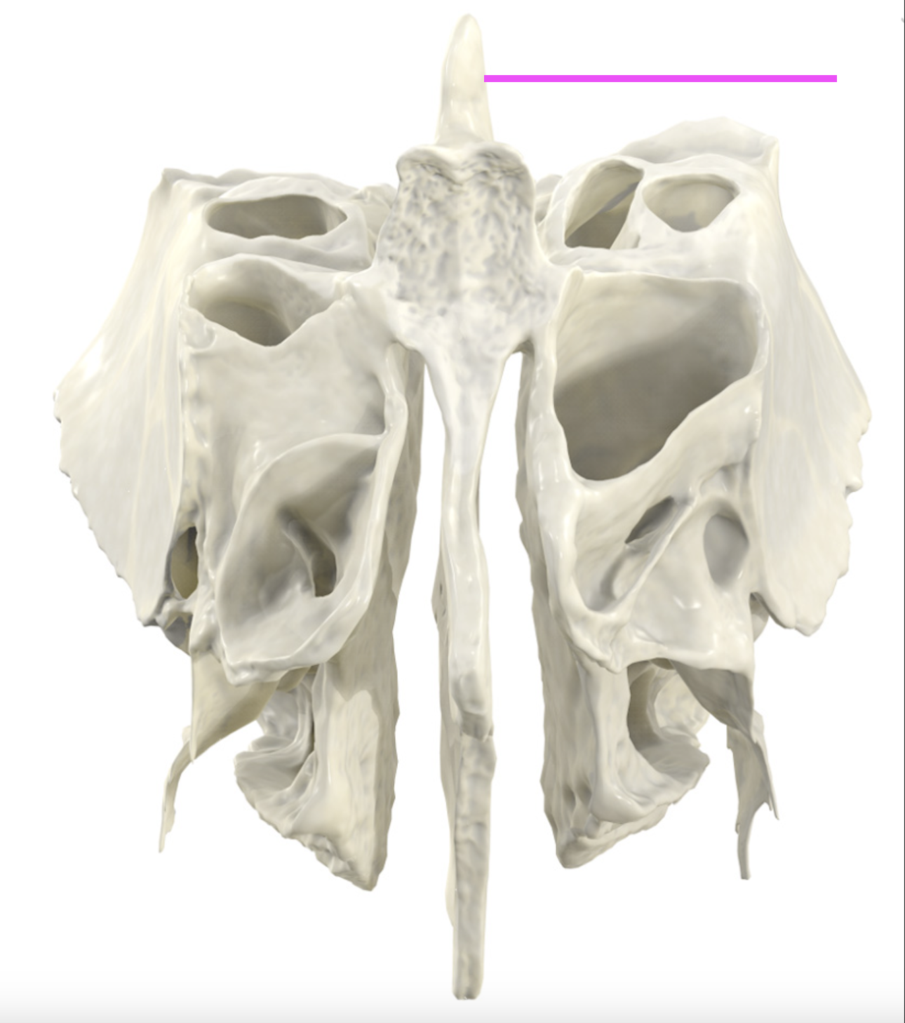 <p>What bone marking is this?</p>
