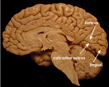 <p>superior part of V1 in the calcarine fissure division</p><p>superior retinal fibers terminate here</p>