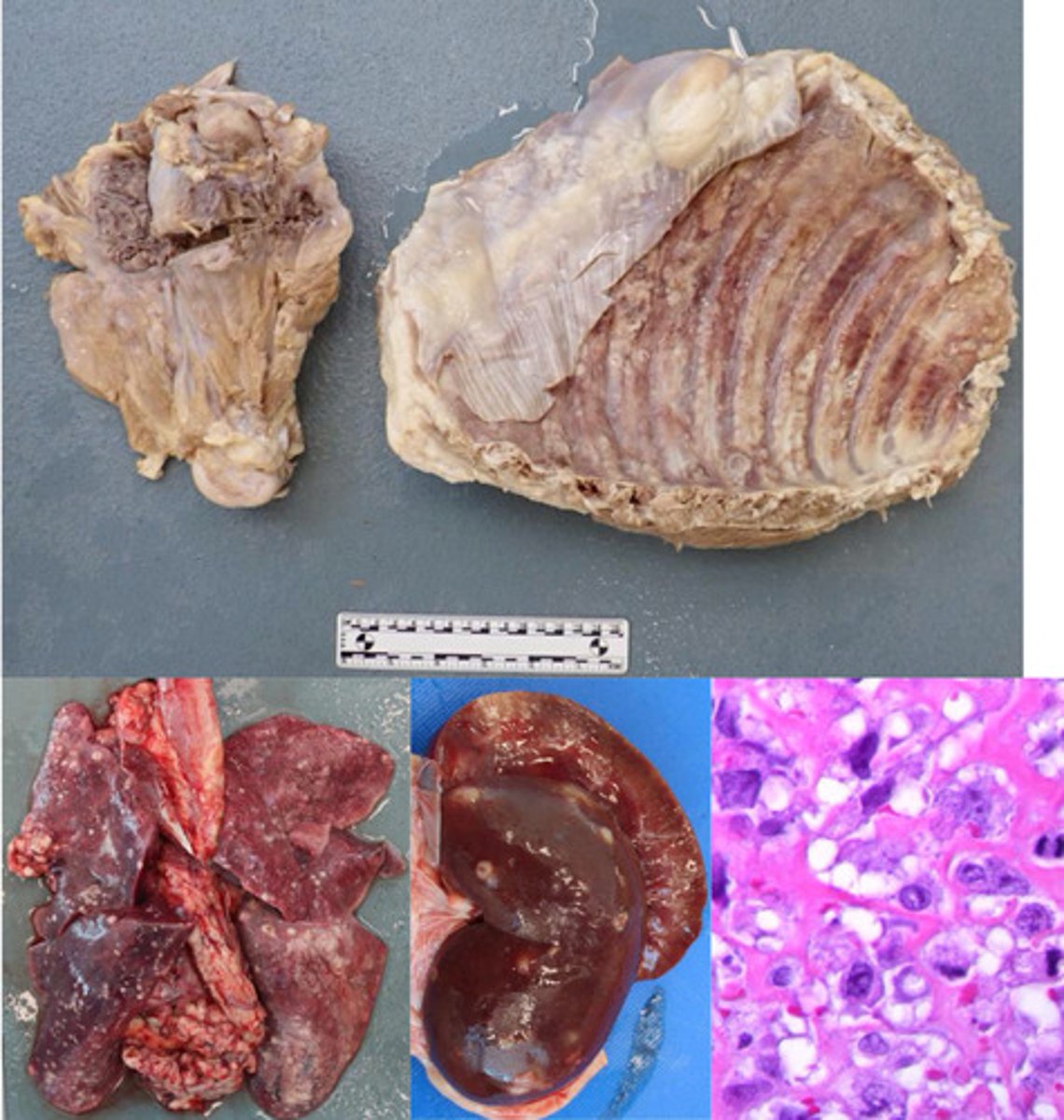 <p>Identify the pathology:</p>