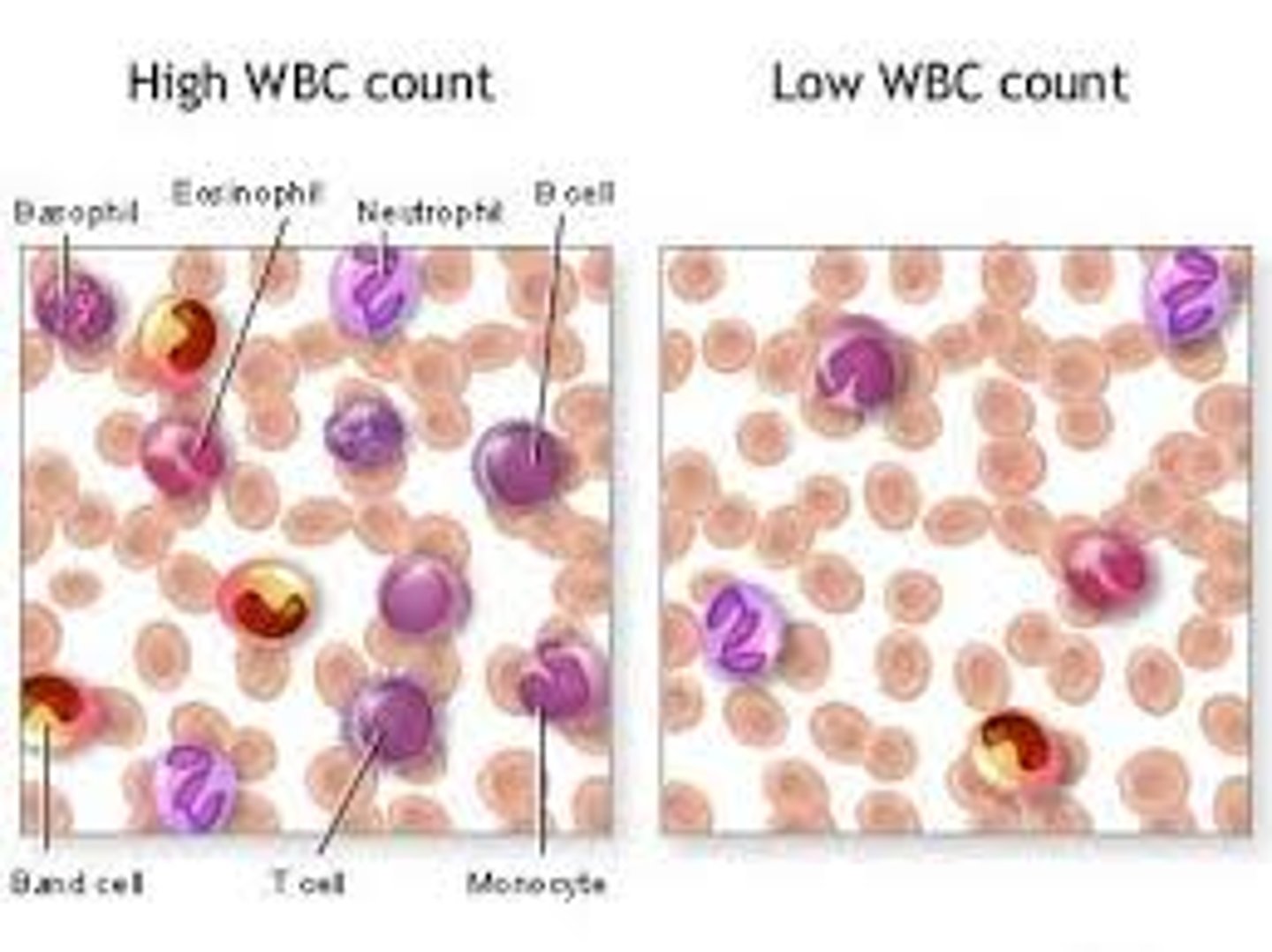 <p>An increase in the number of white blood cells</p>
