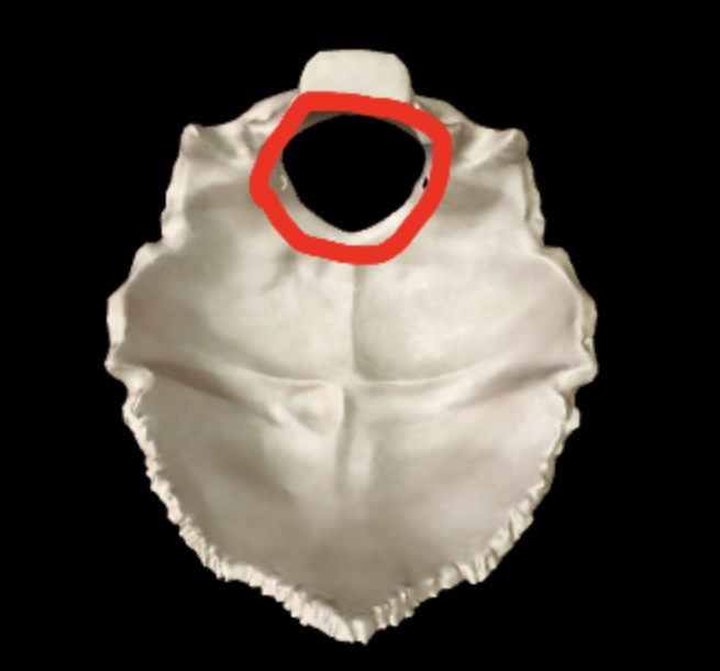 <p>What part of the occipital bone is this?</p>