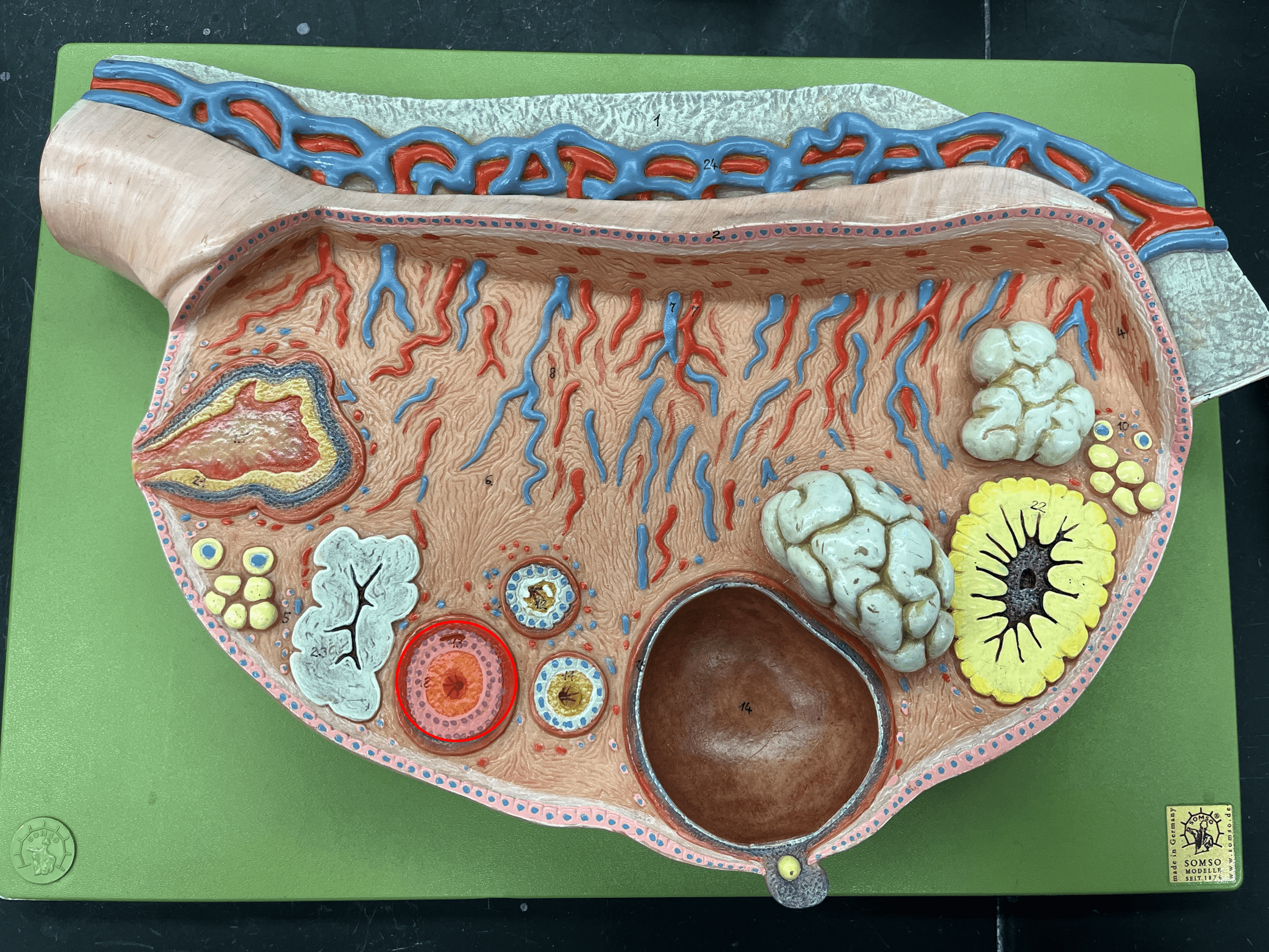 • A ring of supportive cells surrounding an oocyte.

• Composed of an additional layer of granulosa cells in comparison to a primary follicle.

• An antrum may appear.