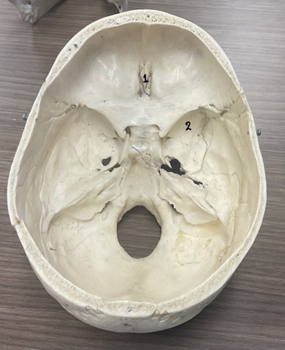 <p>What is structure 2?</p>