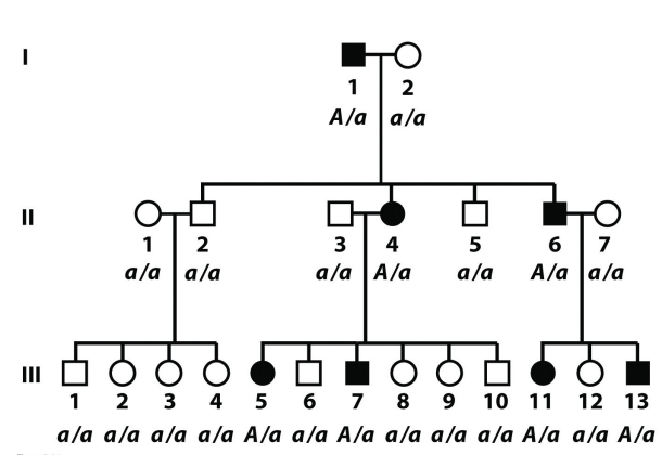* those with disorder are of genotype A/a or A/A
* examples: pseudoachondroplasia, Huntington disease, polydactyly, piebald spotting, etc.
* heterozygotes are most common
* 1:1 mendelian ratio is expected when sample size is large