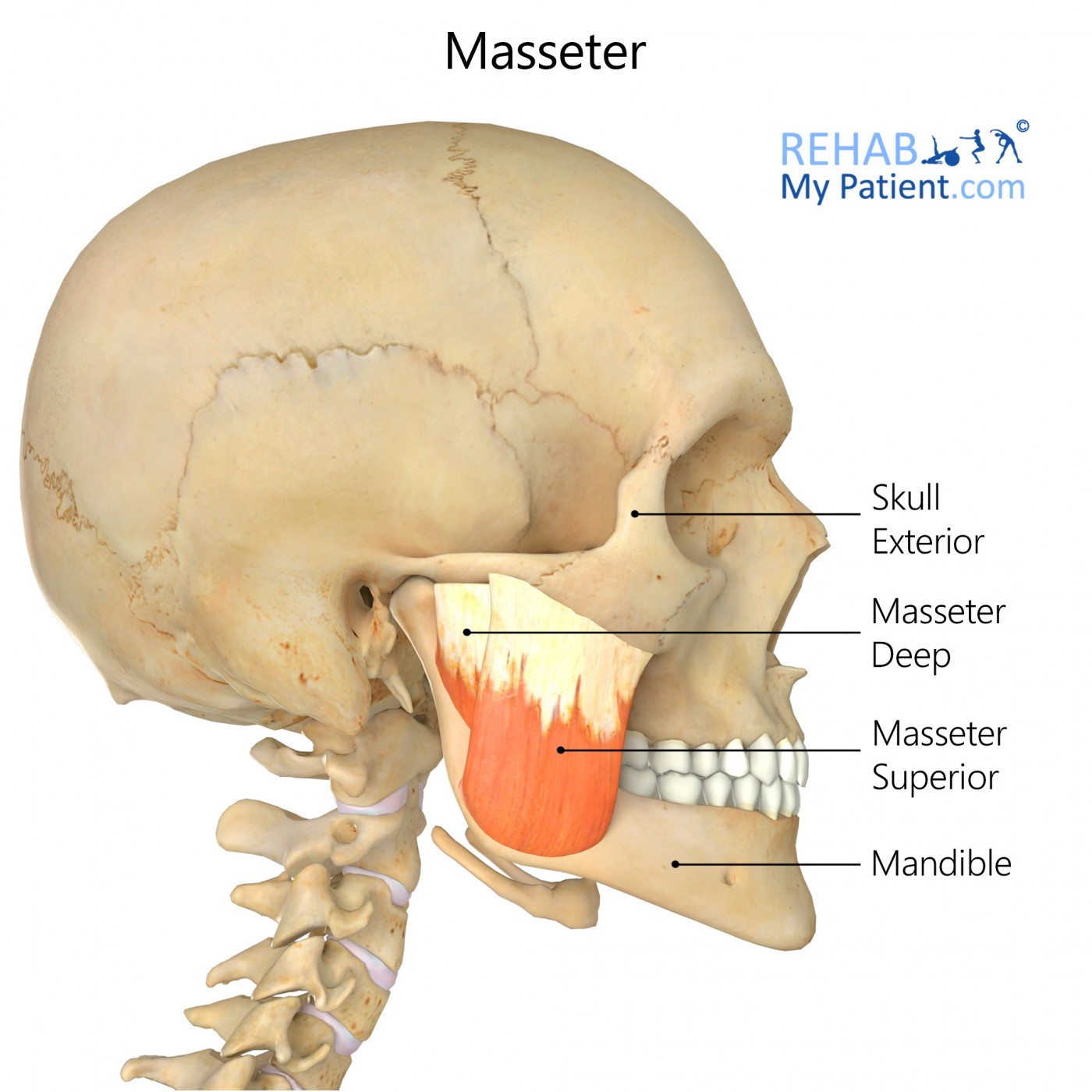 <p><strong>Origin</strong></p><p><span>Inferior border &amp; medial surface of zygomatic arch</span></p><p><strong>Insertion</strong></p><p><span>Lateral surface of ramus of mandible &amp; coronoid process</span></p><p><strong>Peripheral Innervation</strong></p><p>Mandibular Division of Trigeminal Nerve (CN V3)	</p><p><strong>Segmental Innervation</strong></p><p>Mandibular Division of Trigeminal Nerve (CN V3)	</p><p><strong>Action</strong></p><p>Elevates &amp; protrudes mandible; deep fibers retrude</p>