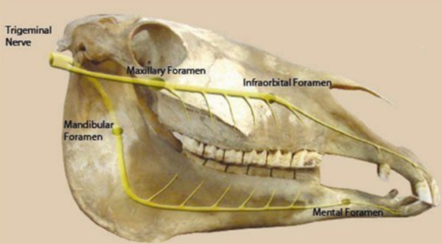 <p>What nerve runs through the mandibular foramen?</p>