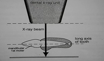 <p>Film and tube head positioning for introral views</p><p>What position is this?</p>
