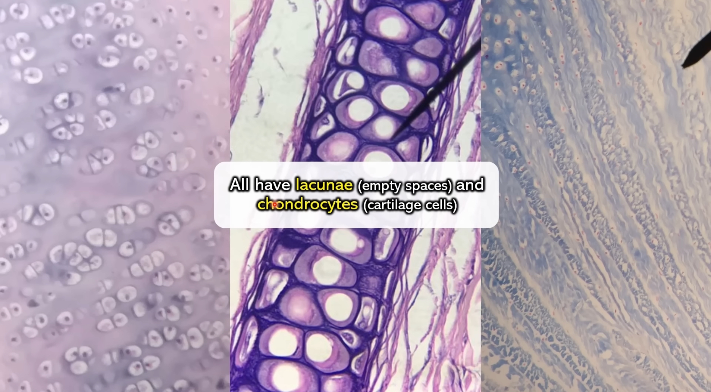 <ol><li><p>hyaline cartilage</p></li><li><p>elastic cartilage </p></li><li><p>fibrocartilage</p></li></ol><p></p>