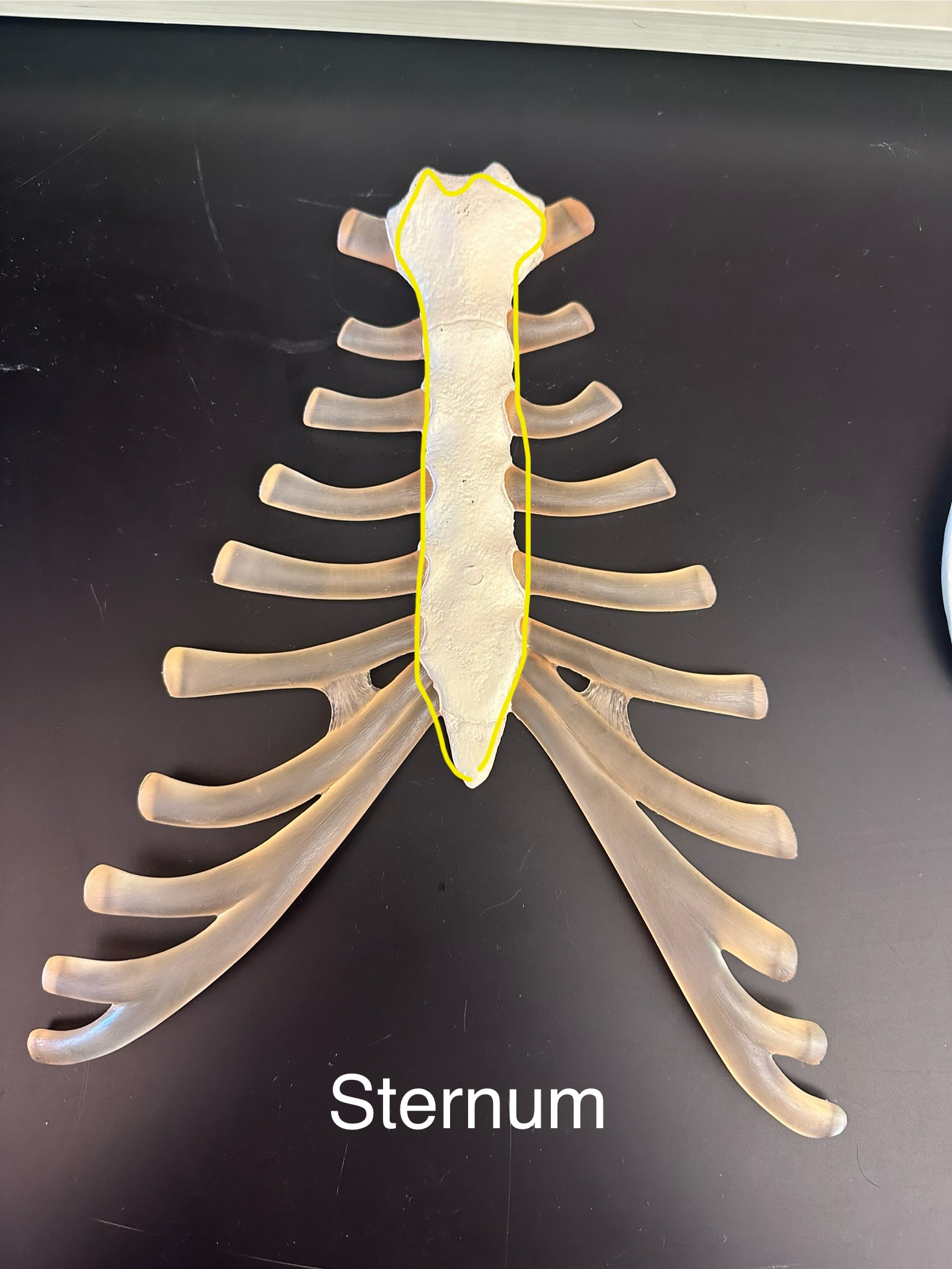 <p>Sternum</p>