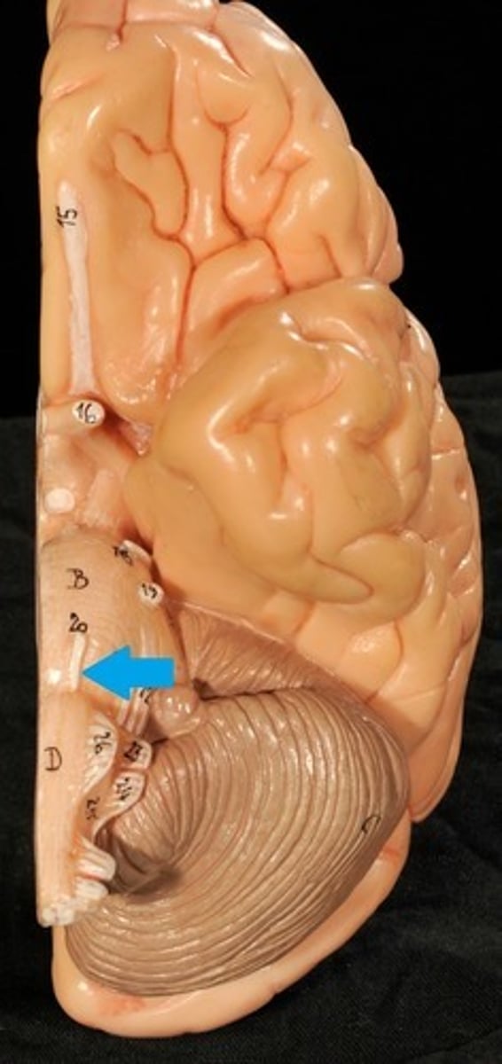 <p>Motor: Eye Movements</p>