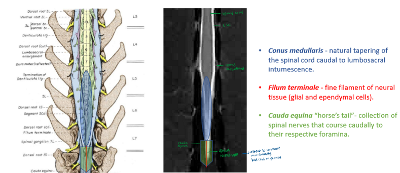 <p>Conus medullaris - natural tapering of spinal cord caudal to lumbosacral inyumescence </p><p>Filum terminale - fine filament of neural tissue</p><p>Cauda equina - connection of spinal nerves that course caudally to their respective foramina </p>